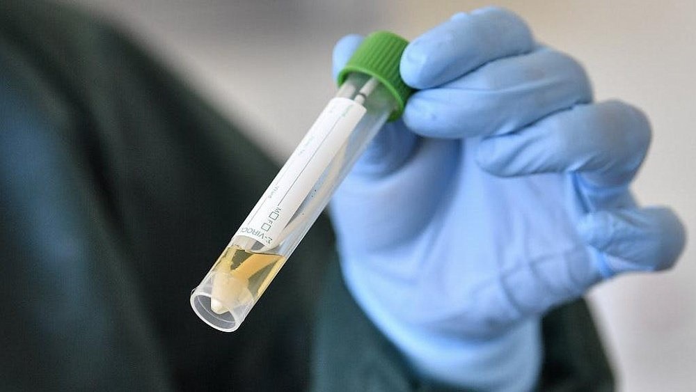 Еще один условно положительный случай заражения коронавирусом выявили в Златоусте